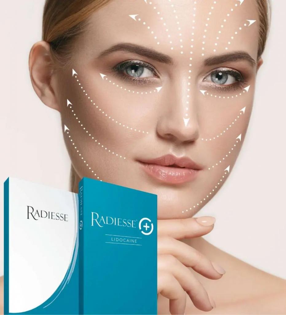 RADIESSE